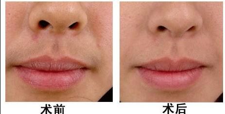 南昌哪家醫(yī)院做美容好的？選擇南昌醫(yī)院美容中心，享受頂級(jí)服務(wù)