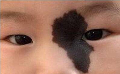 長(zhǎng)沙水光針哪家醫(yī)院好？綜合排名前五的長(zhǎng)沙水光針醫(yī)院推薦！