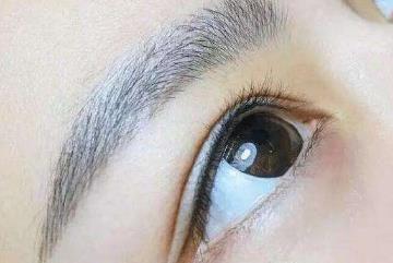 光子嫩膚去痘真的有效嗎？效果能保持多久？