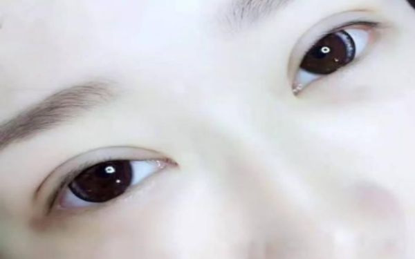 2023蘭州雙眼皮優(yōu)質(zhì)醫(yī)院名單出爐！專家云集，案例和價(jià)格公開！