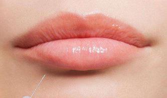 濱州脫毛效果好的醫(yī)院都在哪里？去哪家醫(yī)院脫毛效果更好呢？