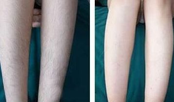 天津面部提升專家推薦，哪家醫(yī)院做面部提升效果好