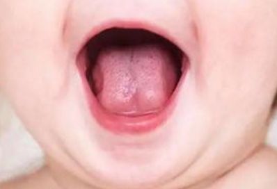 北京看腋臭哪家醫(yī)院效果好？腋下異味專家為您解答！