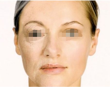 西安除頸紋整形醫(yī)院：深入剖析口碑實(shí)力大起底