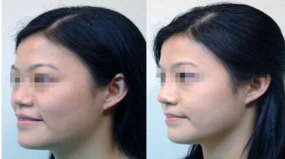 鹽城實(shí)力卓著的靜態(tài)紋肉毒素填充美容機(jī)構(gòu)top榜單