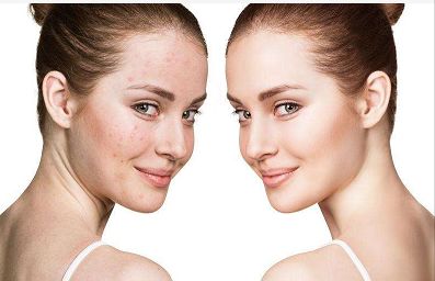 鼻子扁該如何恢復(fù)？實(shí)用治療方法大揭秘！