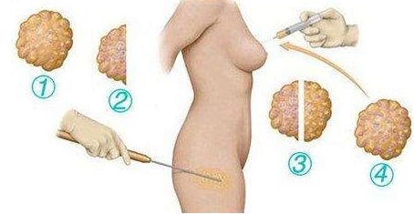 中山面部除皺提升術(shù)整形美容醫(yī)院十佳榜單權(quán)威發(fā)布