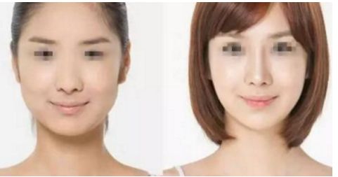 寧波縮陰醫(yī)院口碑排行榜：揭秘女性私密健康之旅