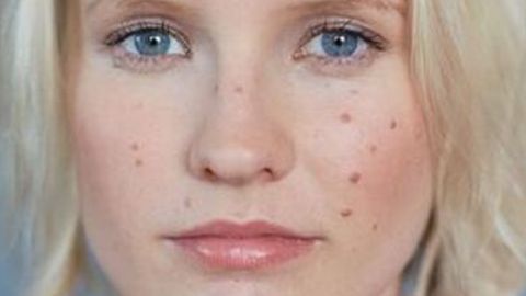 麗水市哪里能找到專業(yè)的激光脫毛服務(wù)？推薦麗水市人民醫(yī)院和杭州秦良忠整形！