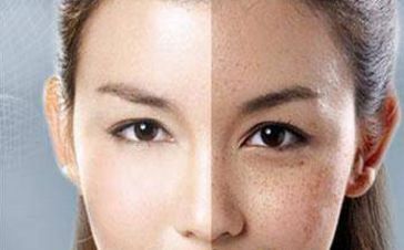 宜昌哪家醫(yī)院除魚(yú)尾紋好？挑選適合自己的專業(yè)醫(yī)院！