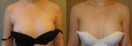 林允兒近期狀態(tài)有何變化？照片來看，31歲的她到底何去何從？