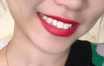 哈爾濱公立整形醫(yī)院哪家效果好？手術(shù)價(jià)格免費(fèi)查詢，你了解哪家比較靠譜？