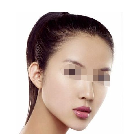 面部輪廓整形：顴骨磨骨+吸脂提升臉型，煥發(fā)全新魅力