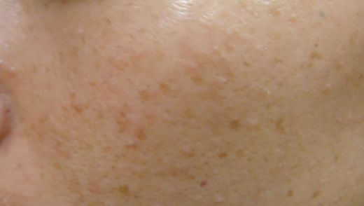 杭州三甲級(jí)醫(yī)院中，哪家擁有最專業(yè)的豐胸醫(yī)療團(tuán)隊(duì)？