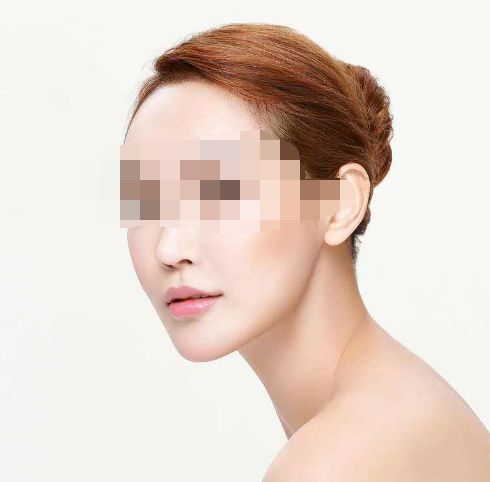 成都吸脂塑身醫(yī)院全方位指南：口碑、技術(shù)、案例解析