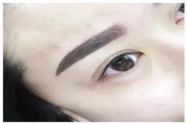 徐子珊再次為外貌進行整容引來熱議，她取得怎樣的效果？