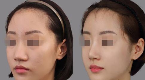 探索貴陽十佳射頻祛除靜態(tài)紋醫(yī)療機(jī)構(gòu)