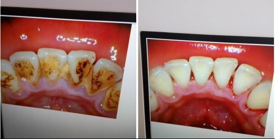 南寧哪家瘦臉針醫(yī)院好？頂級(jí)整形專家告訴你！