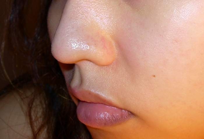 泉州脂管加醫(yī)療美容門診部的資質(zhì)如何？是否擁有優(yōu)秀的醫(yī)生團(tuán)隊(duì)和口碑佳的醫(yī)院？