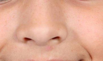 【Top醫(yī)院】2023杭州激光祛斑醫(yī)美推薦，了解價(jià)格、口碑！