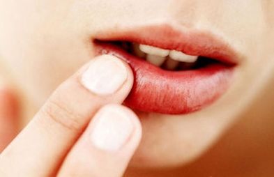 變性之后的poy進(jìn)行了整容手術(shù)，煥然一新