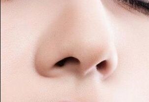 深圳微整形哪家醫(yī)院好？2023年深圳微整形好評醫(yī)院TOP5推薦