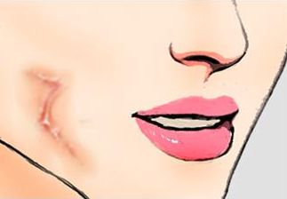 昆明市雙眼皮手術(shù)前5家醫(yī)療機(jī)構(gòu)評(píng)比