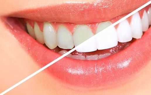 深圳哪家醫(yī)院治療酒糟鼻效果好，哪家醫(yī)院專業(yè)治療酒糟鼻最好