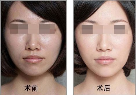 濟南點陣射頻整形醫(yī)院排行榜：十強名錄一覽