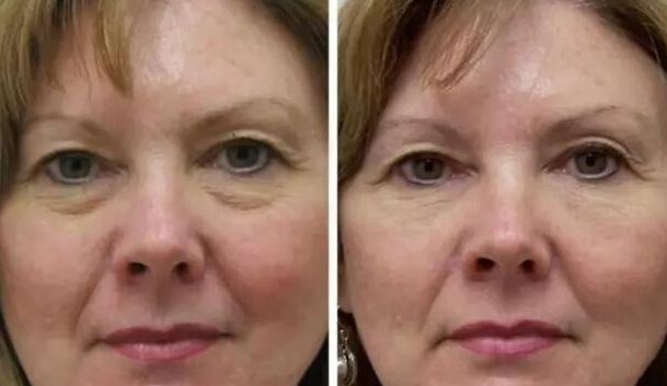 鄭州祛疤修復前十醫(yī)院精選，為你呈現(xiàn)疤痕無憂人生！