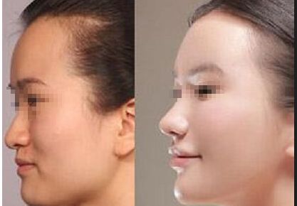 深圳注射溶脂針瘦手臂醫(yī)院排行榜前10大，口碑超贊！