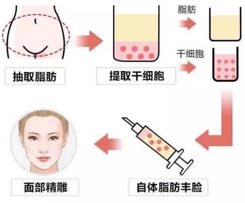 深圳優(yōu)質(zhì)韓式微創(chuàng)磨骨醫(yī)療整形醫(yī)院前十強(qiáng)推薦