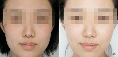 咸陽整形醫(yī)院人氣榜單TOP10