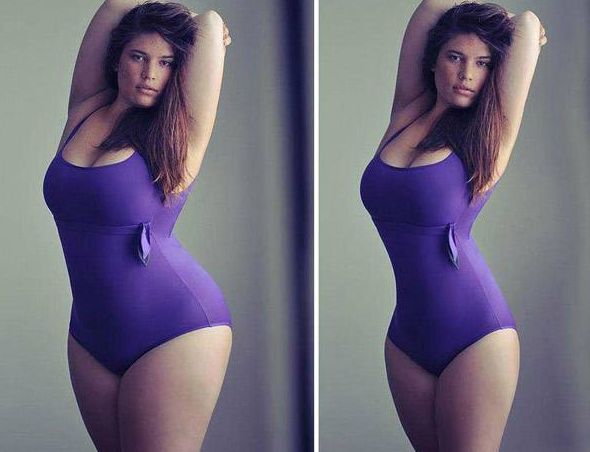 河北面部玻尿酸注射口碑好醫(yī)院推薦