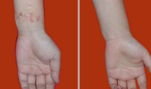 淄博下眼瞼成形術(shù)醫(yī)院前十強(qiáng)推薦，打造電力十足雙眼