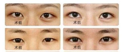 吉林市隆胸案例推薦：Top6整形醫(yī)院，專業(yè)選擇有保障