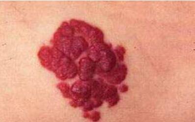 超聲炮能帶來哪些好處和壞處？它有何作用？