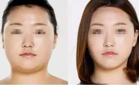 杭州權(quán)威滾針祛老年斑醫(yī)院推薦