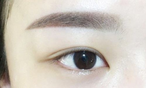 鄭州哪家醫(yī)院做面部吸脂好？