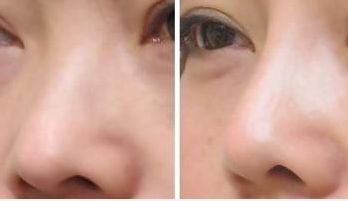 西安最受歡迎的頸部美容醫(yī)院排行榜，專業(yè)口碑匯總