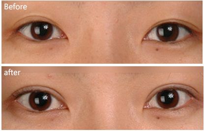 錦州外陰整形醫(yī)院哪家效果最好又靠譜？