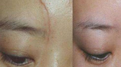 張曉玲整容成功了嗎？探索她的變化與心態(tài)轉(zhuǎn)變