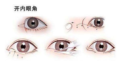 蘇州哪家醫(yī)院整形科好？選擇合適整形醫(yī)院，打造完美容顏。