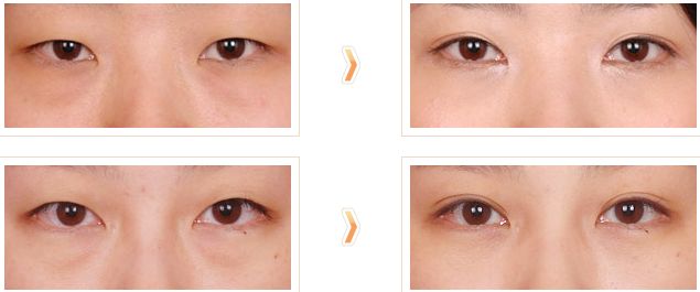 洛陽市專業(yè)祛疤醫(yī)院哪家好？洛陽市祛疤醫(yī)院排名及推薦