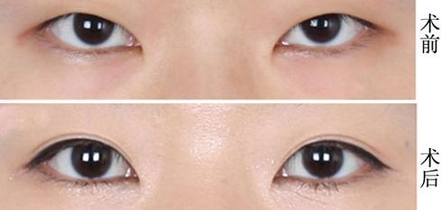 上海哪家醫(yī)院疤痕修復(fù)效果好？