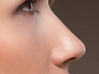 昆明祛除雀斑醫(yī)院哪家好？探尋昆明當?shù)貙I(yè)雀斑去除醫(yī)院推薦