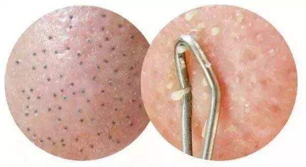 2023溫州豐太陽(yáng)穴醫(yī)院清單發(fā)布！技術(shù)一流，醫(yī)療值得信賴(lài)！