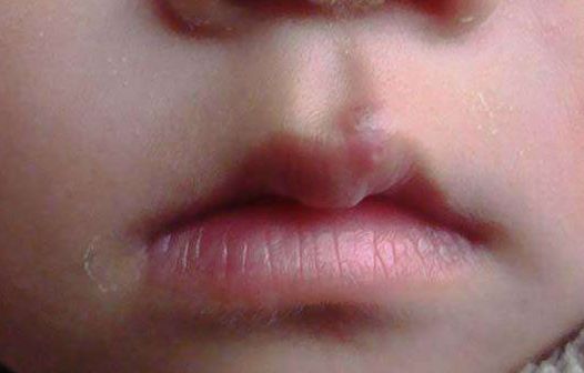 濰坊豐胸哪家整形醫(yī)院靠譜？