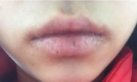 遼寧豐胸整形醫(yī)院哪家好？解讀2023年遼寧豐胸整形醫(yī)院綜合排名