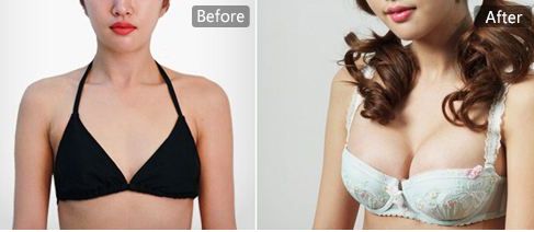 蘇州祛痘效果最好的醫(yī)院有哪些？